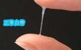 排卵期白带症状
