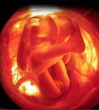 四维彩超检查对有胎儿什么作用