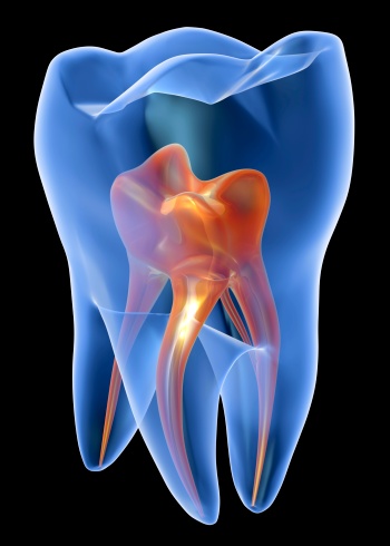 牙髓炎怎么办 牙髓炎的防治措施