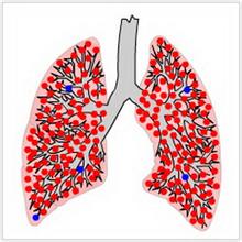肺结核常见早期症状