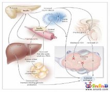 多囊卵巢综合症（PCOS）诊断中提及到的肥胖