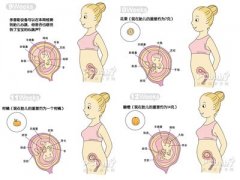 怀孕3个月胎儿发育过程图